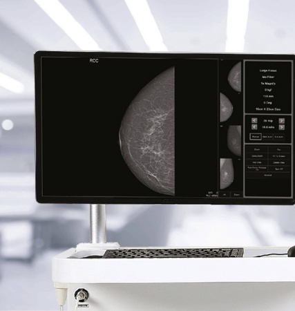 Цифровой маммограф Genoray DMX-600