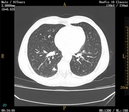 Компьютерный томограф NeuViz 16 Classic CT Neusoft
