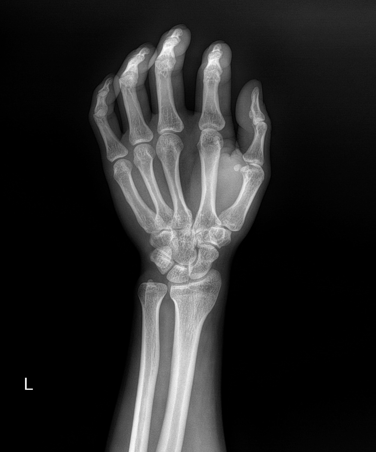 Drgem Diamond PREMIUM - роботизированный рентген аппарат премиум класса