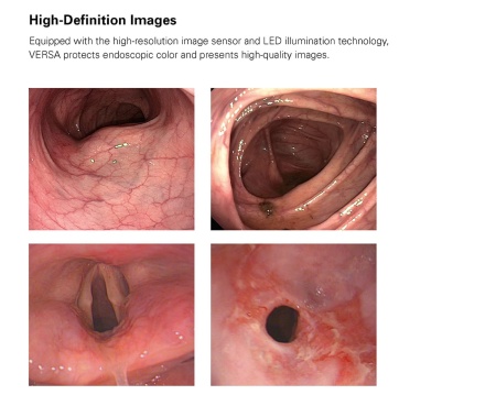 Видеопроцессор Pentax Versa EPK-V1500c