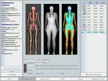 Рентгеновский костный денситометр Stratos DMS