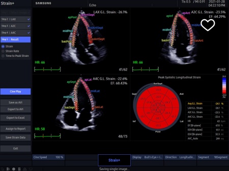 Аппарат УЗИ Samsung Medison HM70 EVO