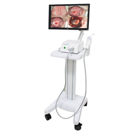 Видеокольпоскоп Dr. Camscope DCS-102