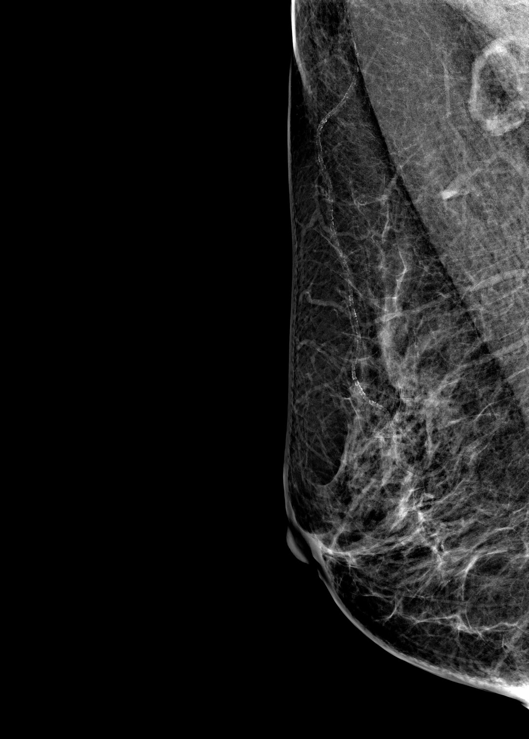 Цифровой маммограф Brestige Expert Indirect