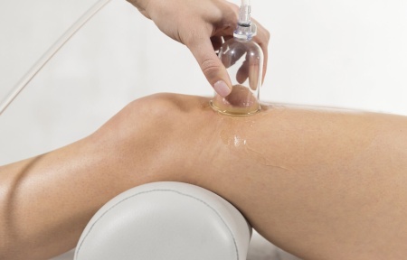 Система вакуумной терапии VACU-ACTOR