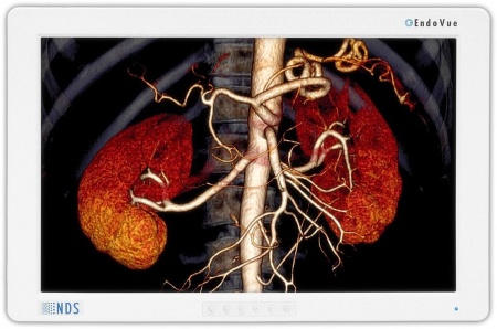 Эндоскопическая стойка для бронхоскопии EPX-4450HD Fujifilm