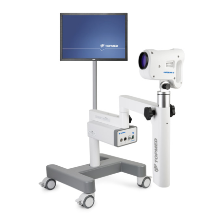 Видеокольпоскоп TOPMED Colposcope HD