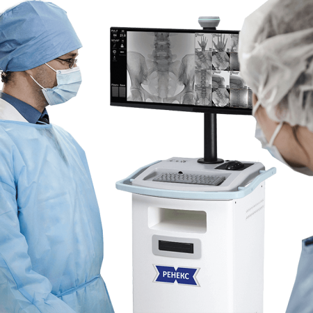 Рентген типа C-дуга «Ренекс» 15 кВт с цифровым ППД - Цена по запросу