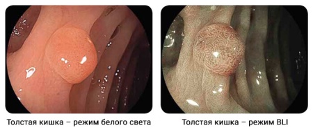 Источник света эндоскопический BL-7000 Fujifilm