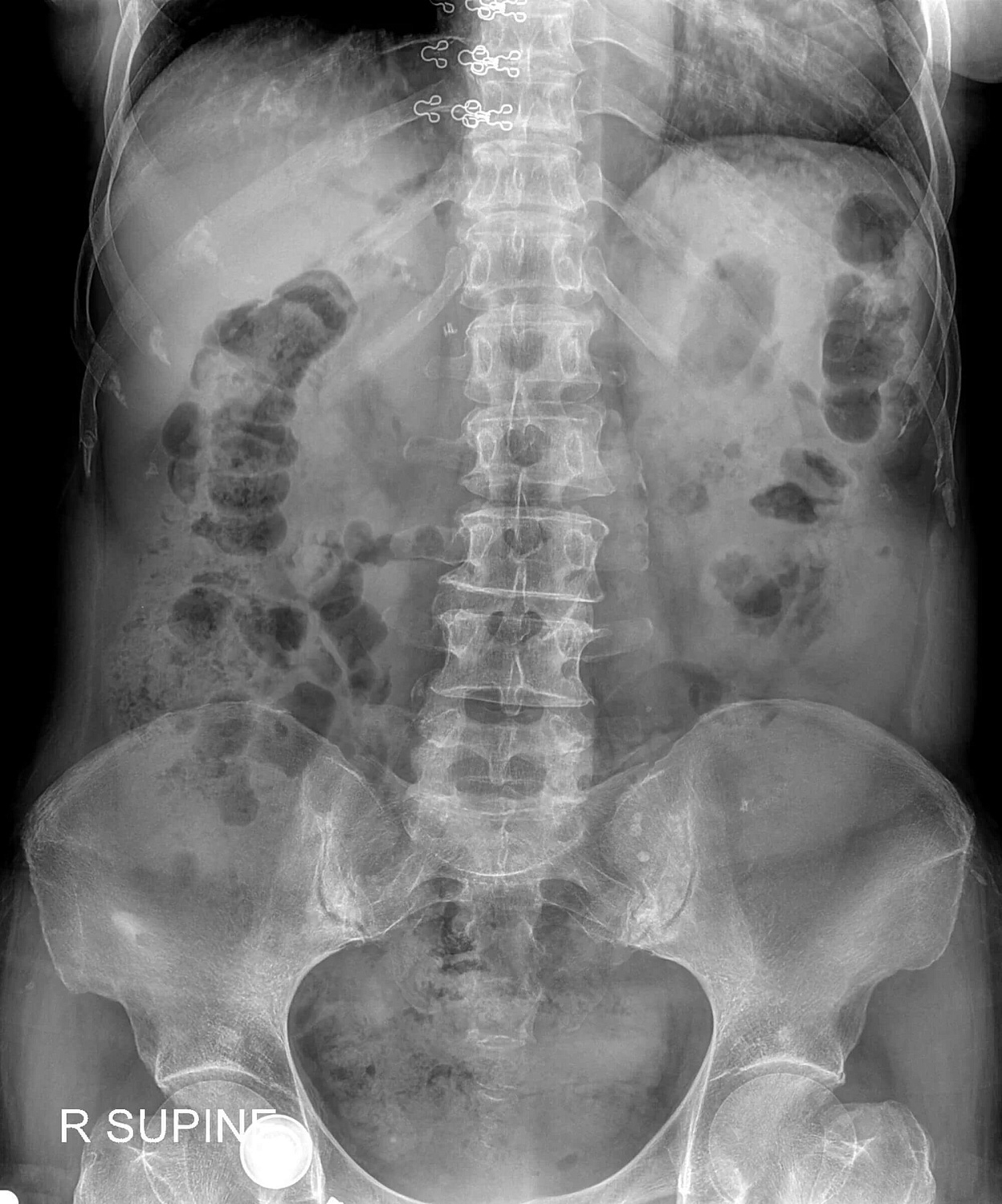 Открылся шоурум рентген-аппаратов Drgem в Москве