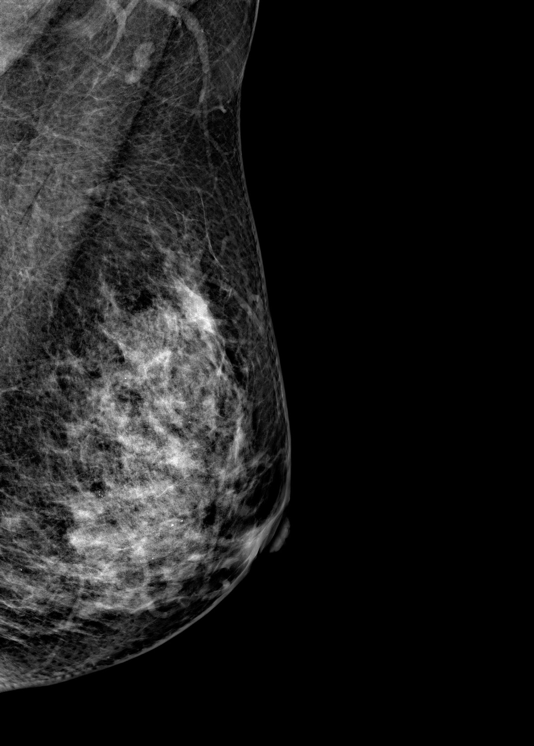 Цифровой маммограф Brestige Expert Indirect