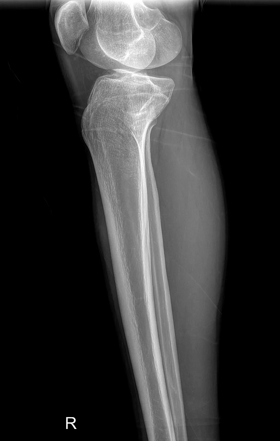 Drgem Diamond PREMIUM - роботизированный рентген аппарат премиум класса