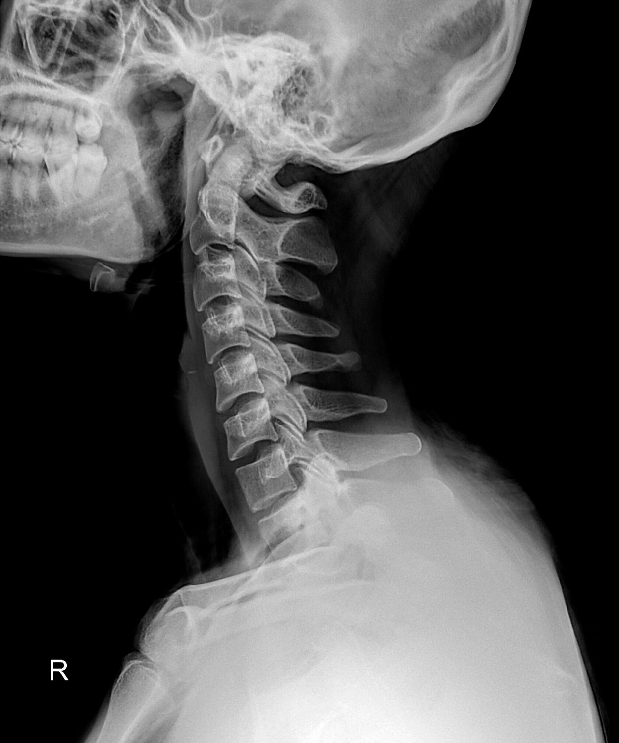 Открылся шоурум рентген-аппаратов Drgem в Москве