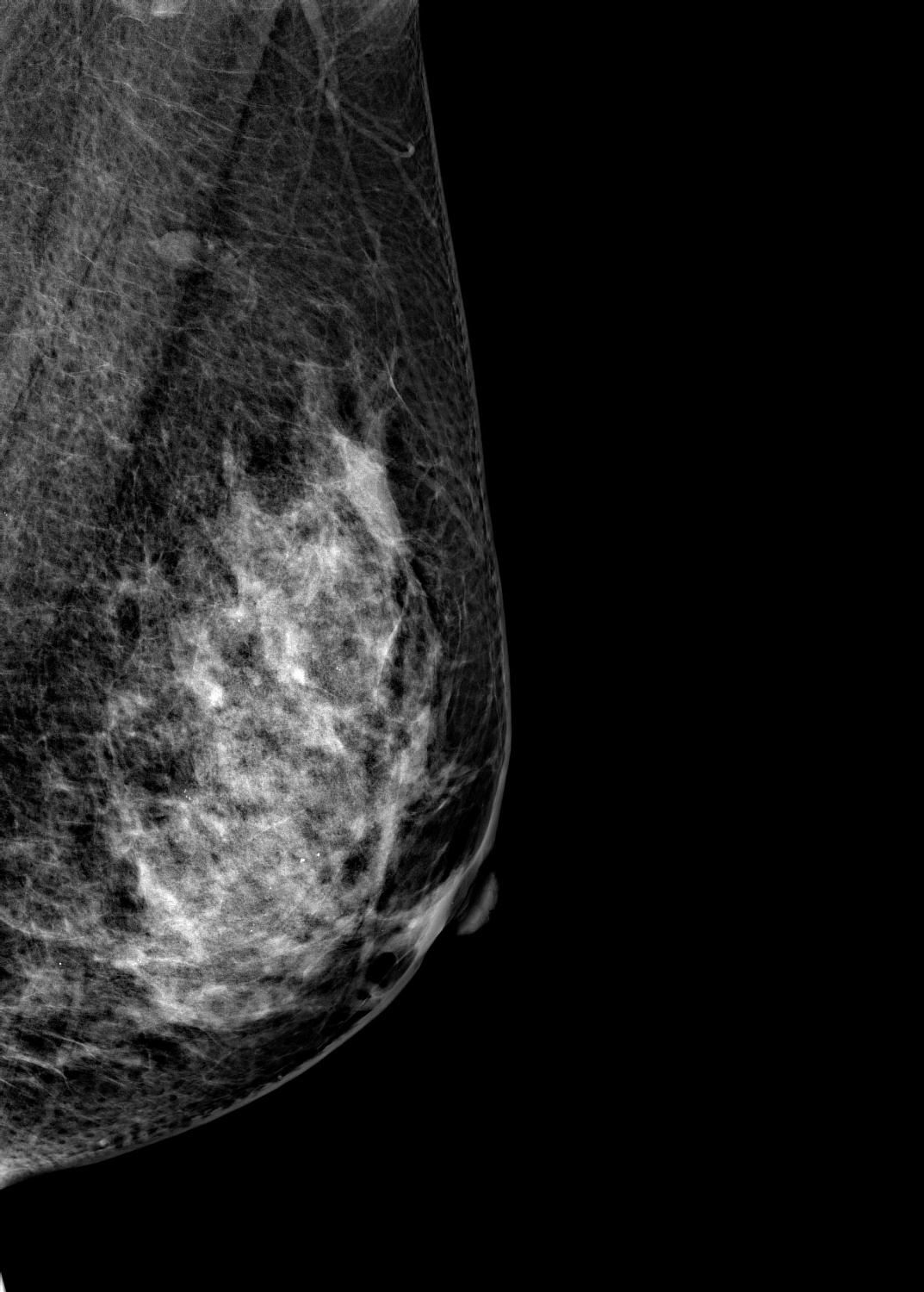 Цифровой маммограф Brestige Expert Indirect