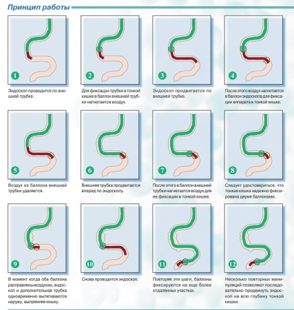 Двухбаллонная эндоскопическая система DBE Fujifilm