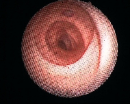 Колонофиброскоп Pentax FC-38LV