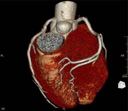 Компьютерный томограф NeuViz Prime CT Neusoft
