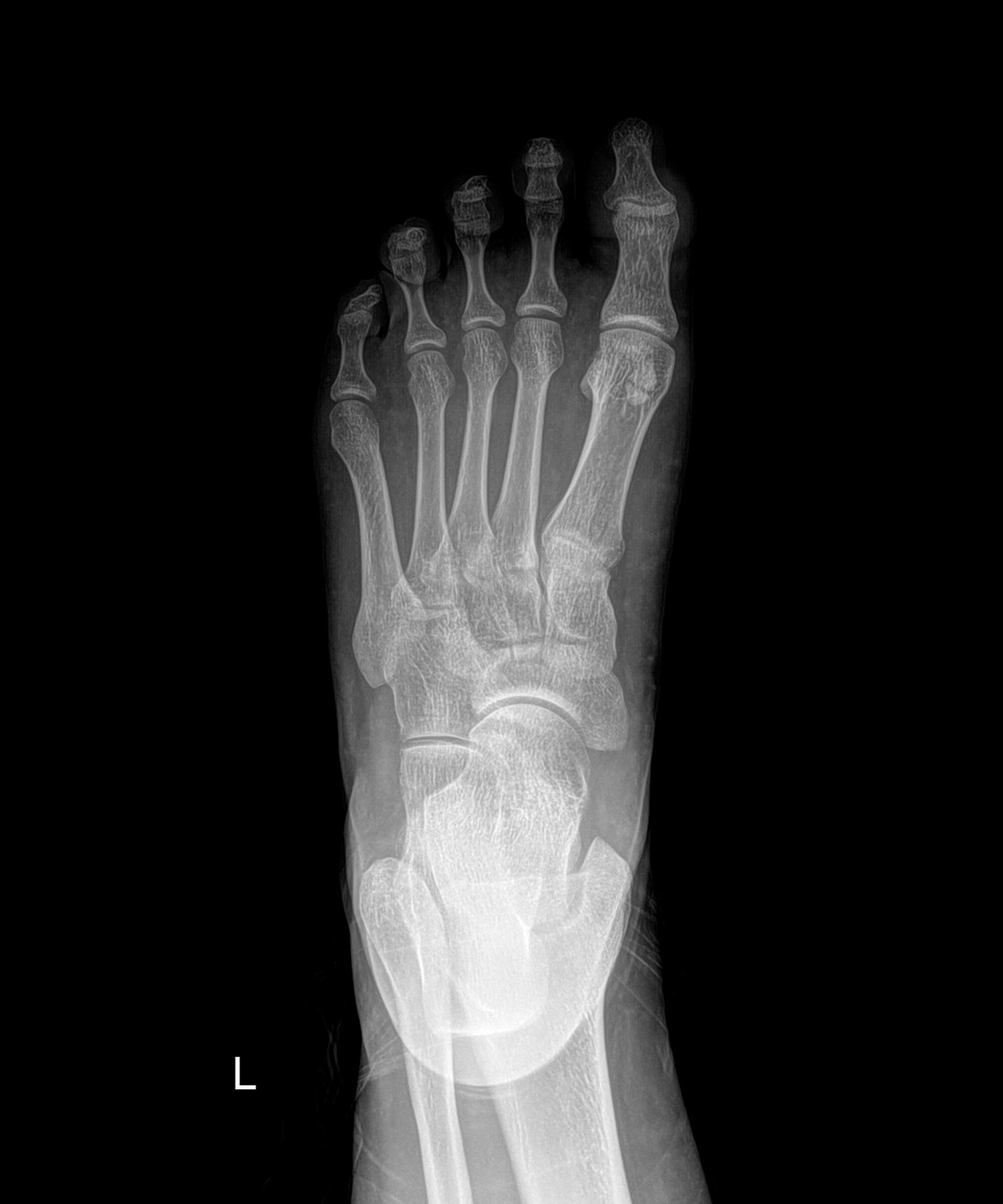 Drgem Diamond PREMIUM - роботизированный рентген аппарат премиум класса