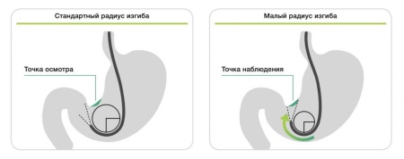 Видеогастроскоп Fujifilm EG-760Z