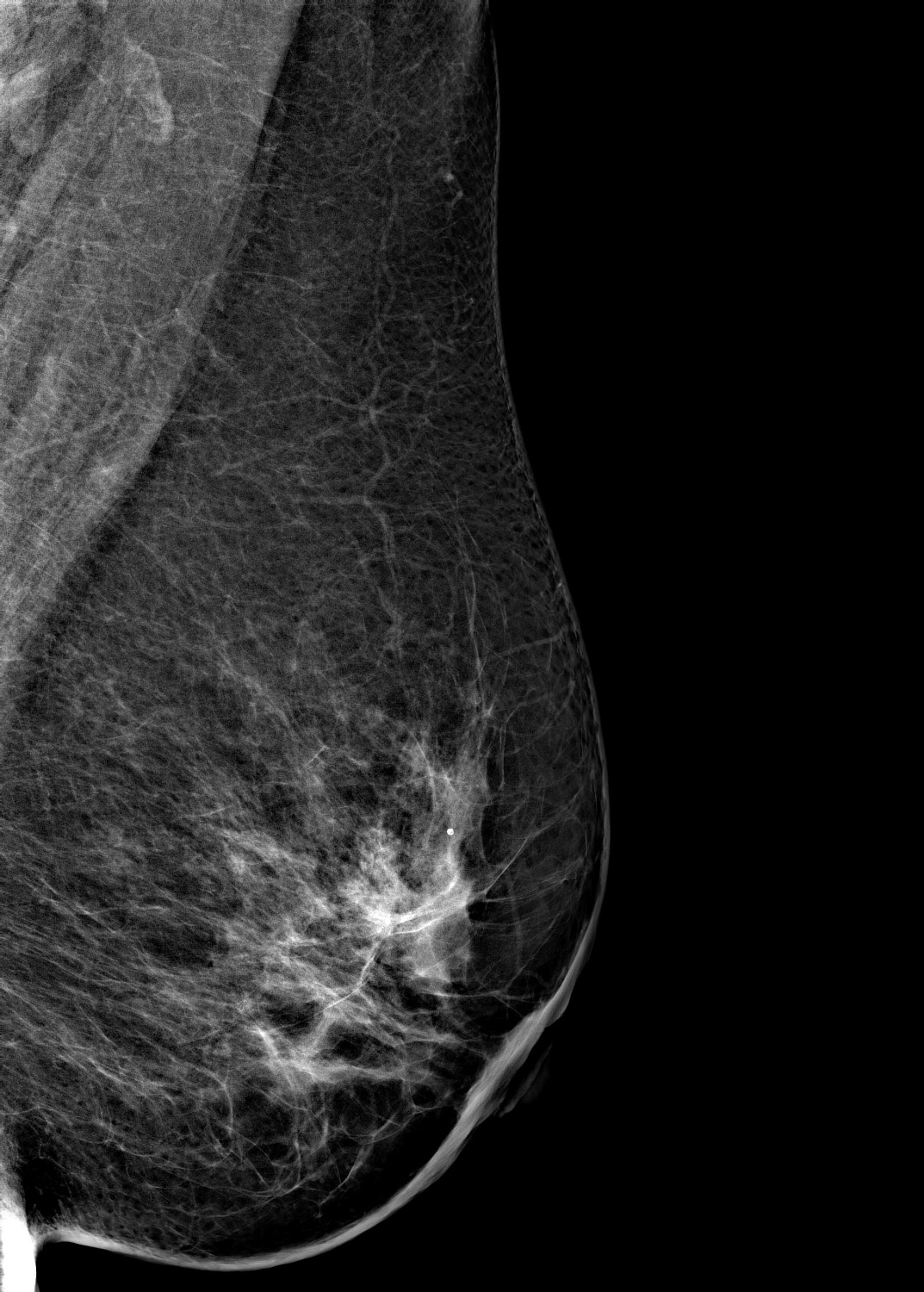 Цифровой маммограф Brestige Expert Indirect