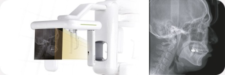 Дентальный томограф Genoray Papaya 3D без цефалостата