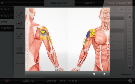 Аппарат ударно-волновой терапии MASTERPULS MP50 ULTRA