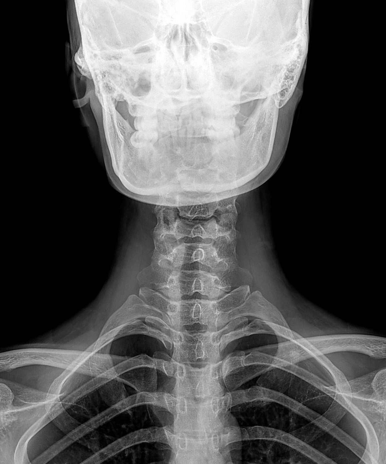 Drgem Diamond PREMIUM - роботизированный рентген аппарат премиум класса