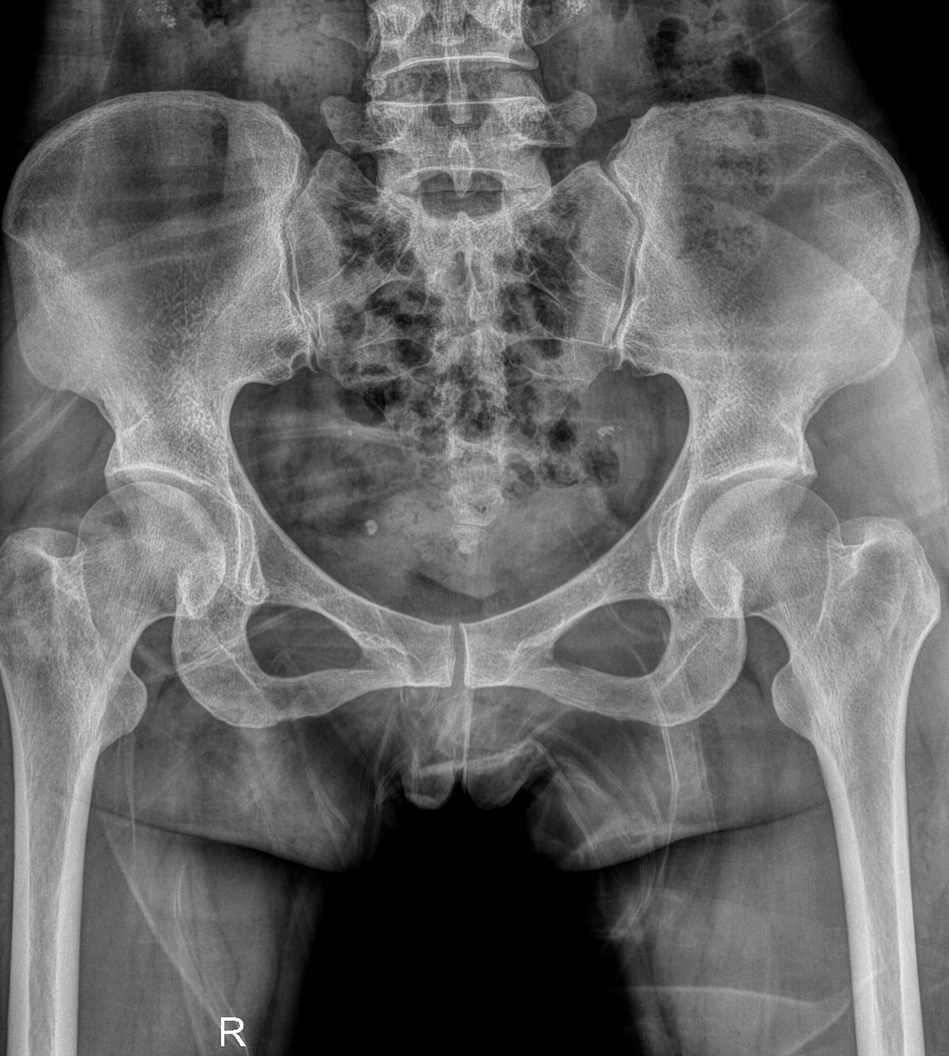 Drgem Diamond PREMIUM - роботизированный рентген аппарат премиум класса