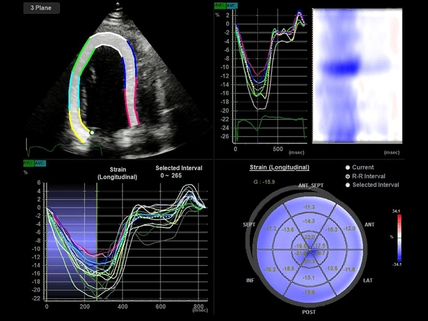 Аппарат УЗИ Samsung Medison HS40