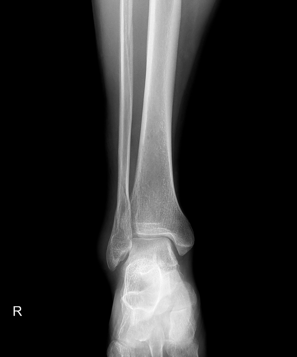 Drgem Diamond PREMIUM - роботизированный рентген аппарат премиум класса