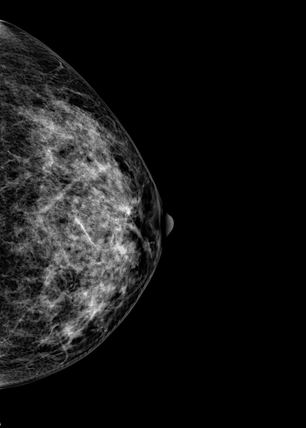 Цифровой маммограф Brestige Expert Indirect