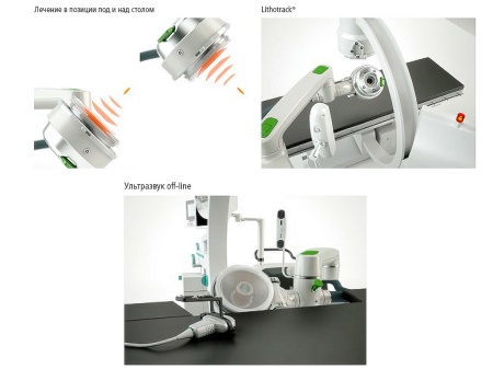 Передвижной экстракорпоральный литотриптор MODULITH SLK «Intelect»