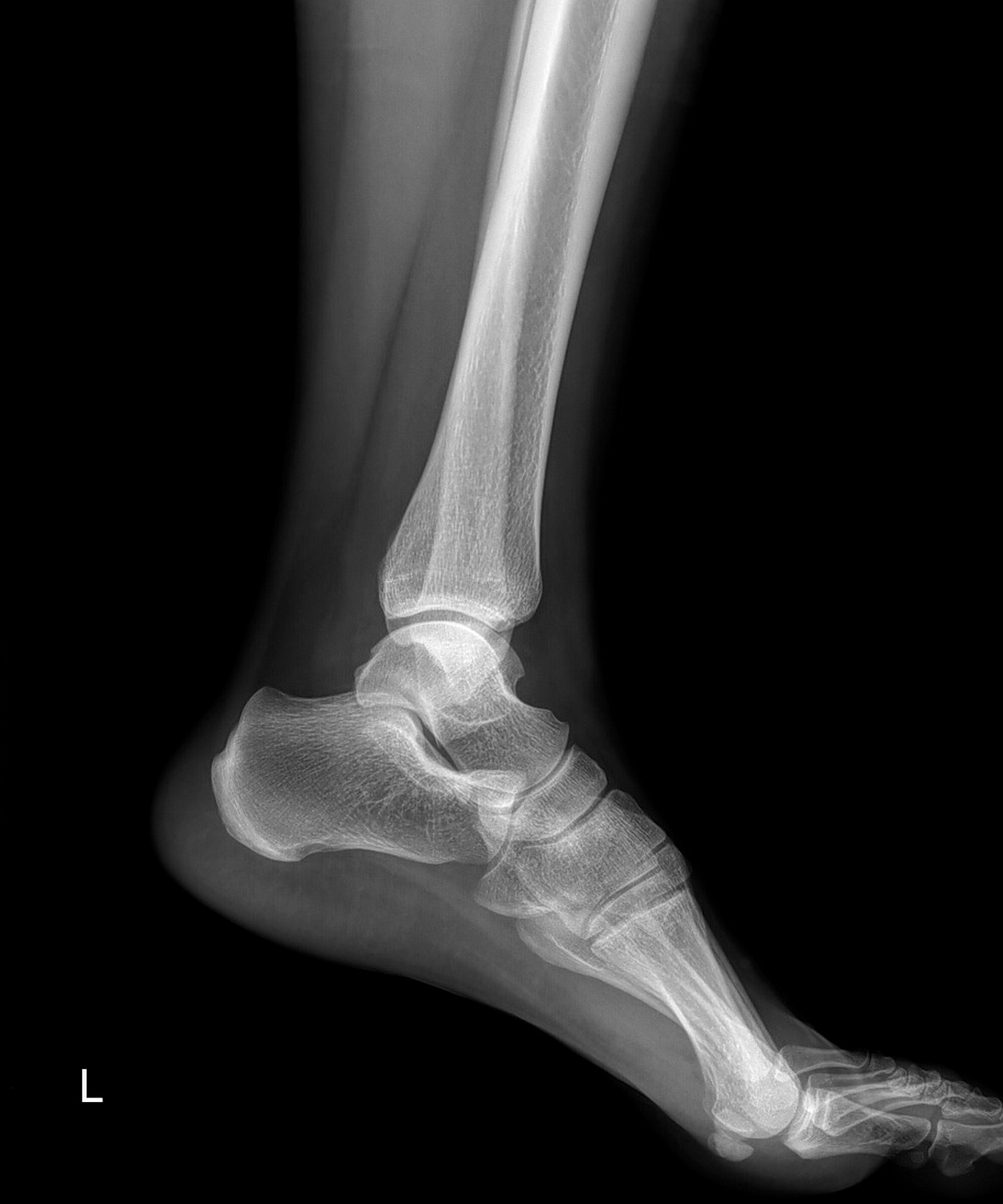 Drgem Diamond PREMIUM - роботизированный рентген аппарат премиум класса