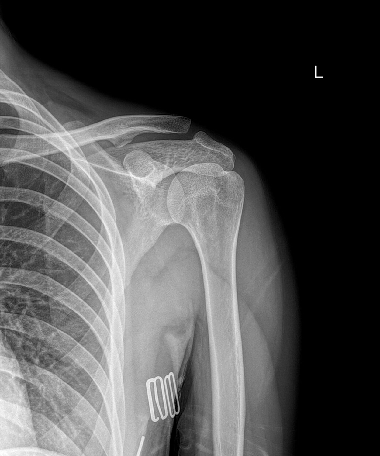 Открылся шоурум рентген-аппаратов Drgem в Москве