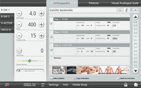 Аппарат ударно-волновой терапии MASTERPULS MP50 ULTRA